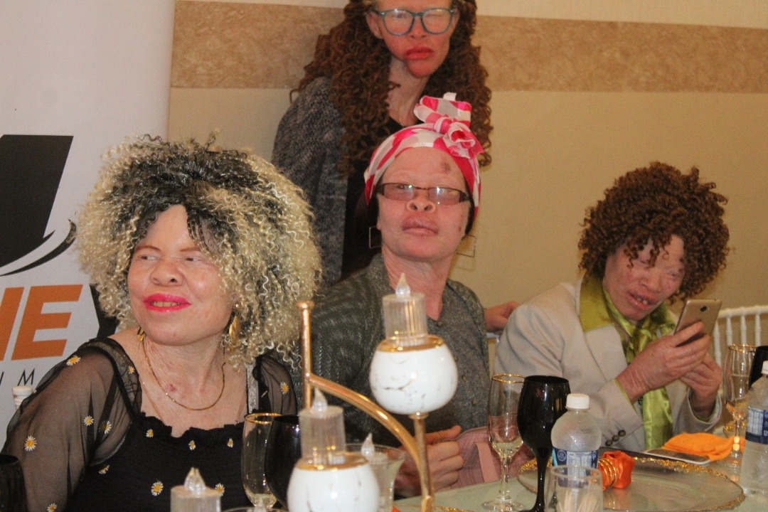 Times-Pic- It was all fun at the Netone even for those living with albinism (1)